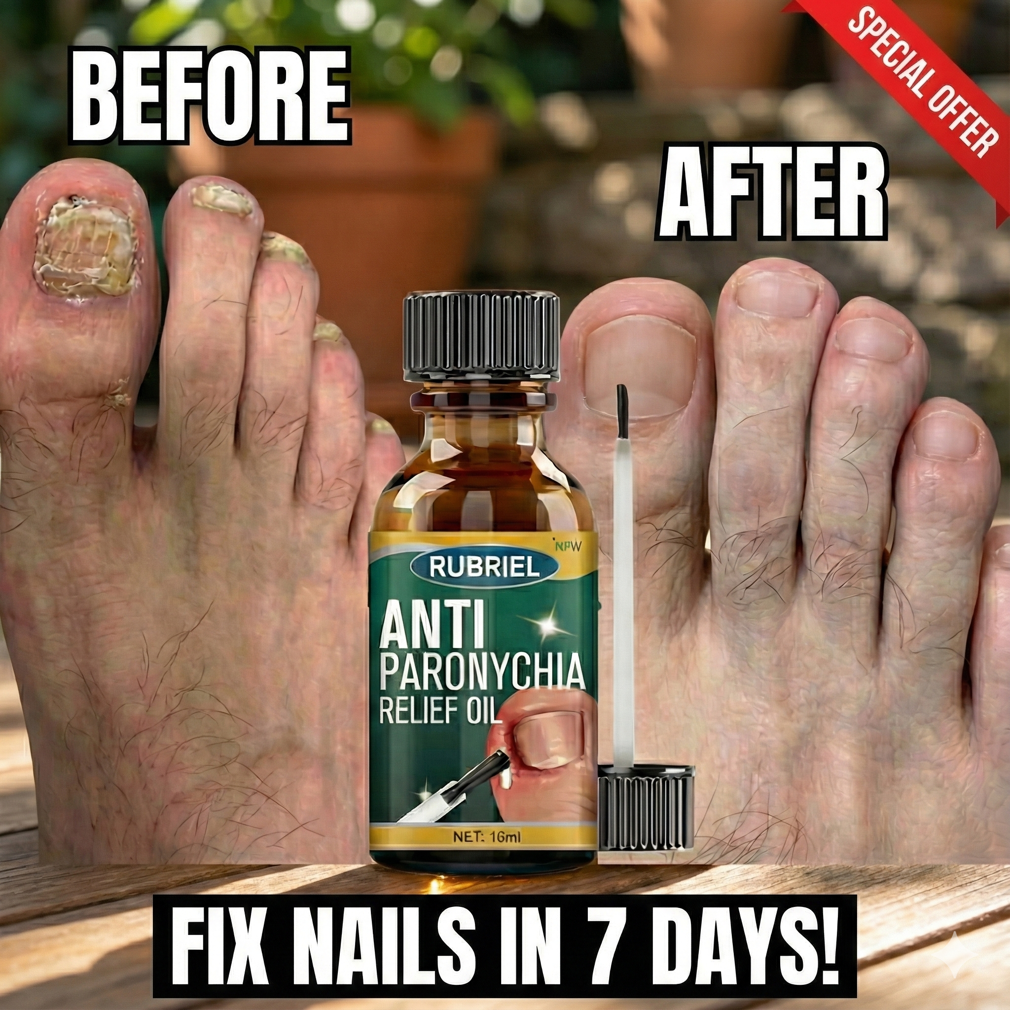 Anti Paronychia Relief Oil - (Buy 1 Get 1 FREE🔥🔥)